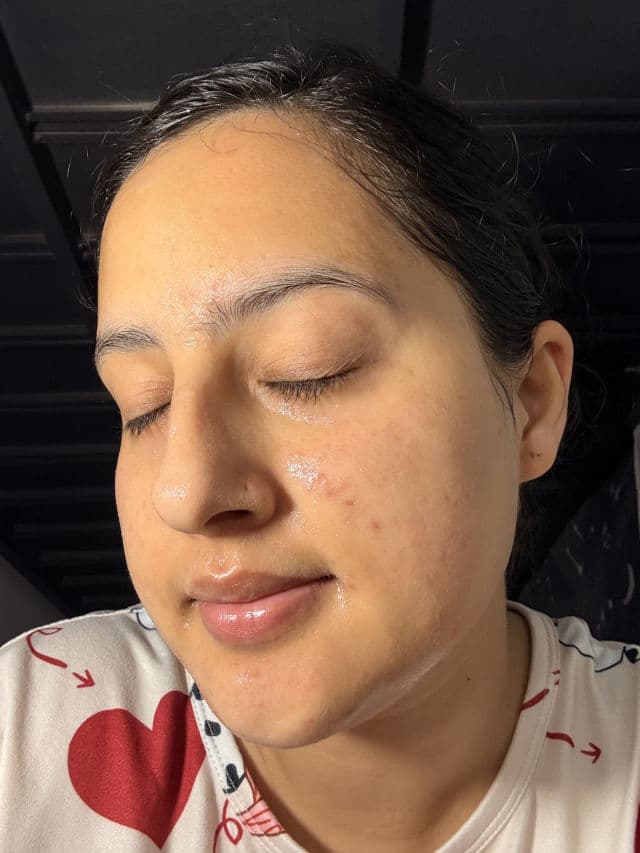 VT COSMETICS Reedle Shot 300 review photo by SreeZana