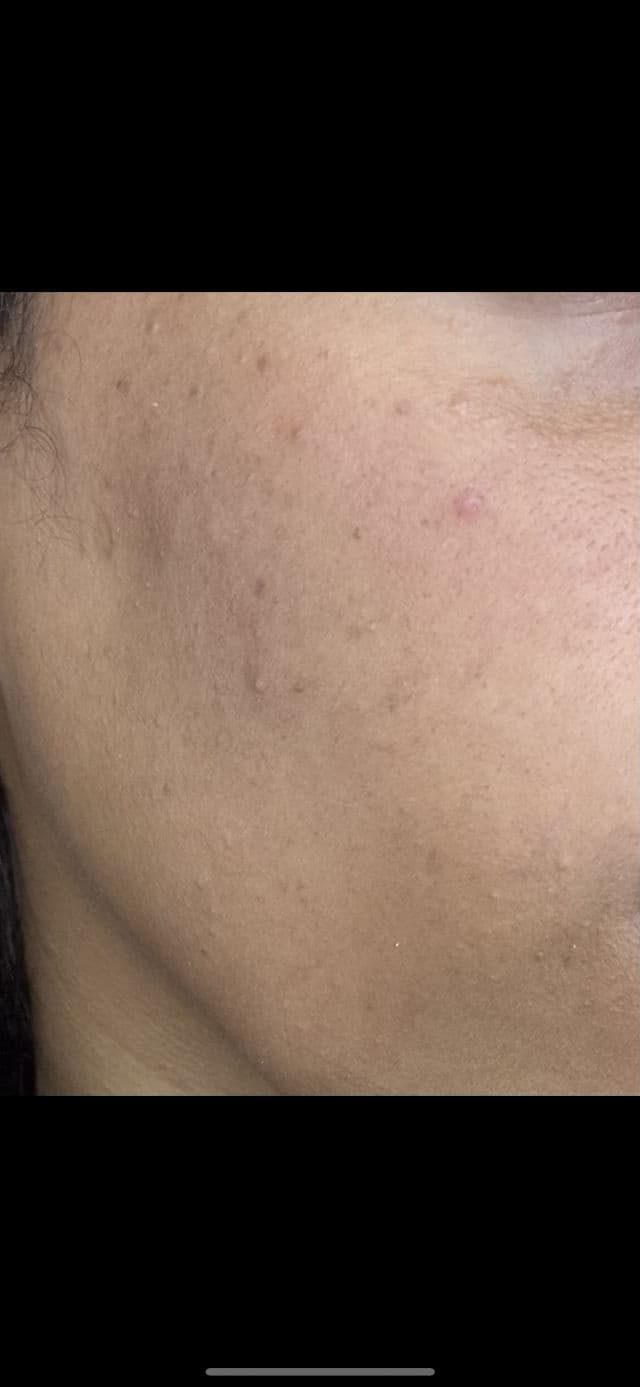 Iunik Beta Glucan Power Moisture Serum review photo by penelope123