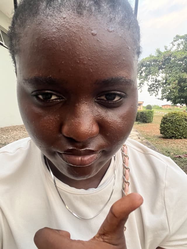 Creightons Salicylic Acid Exfoliating Tonic  review photo by naatasha