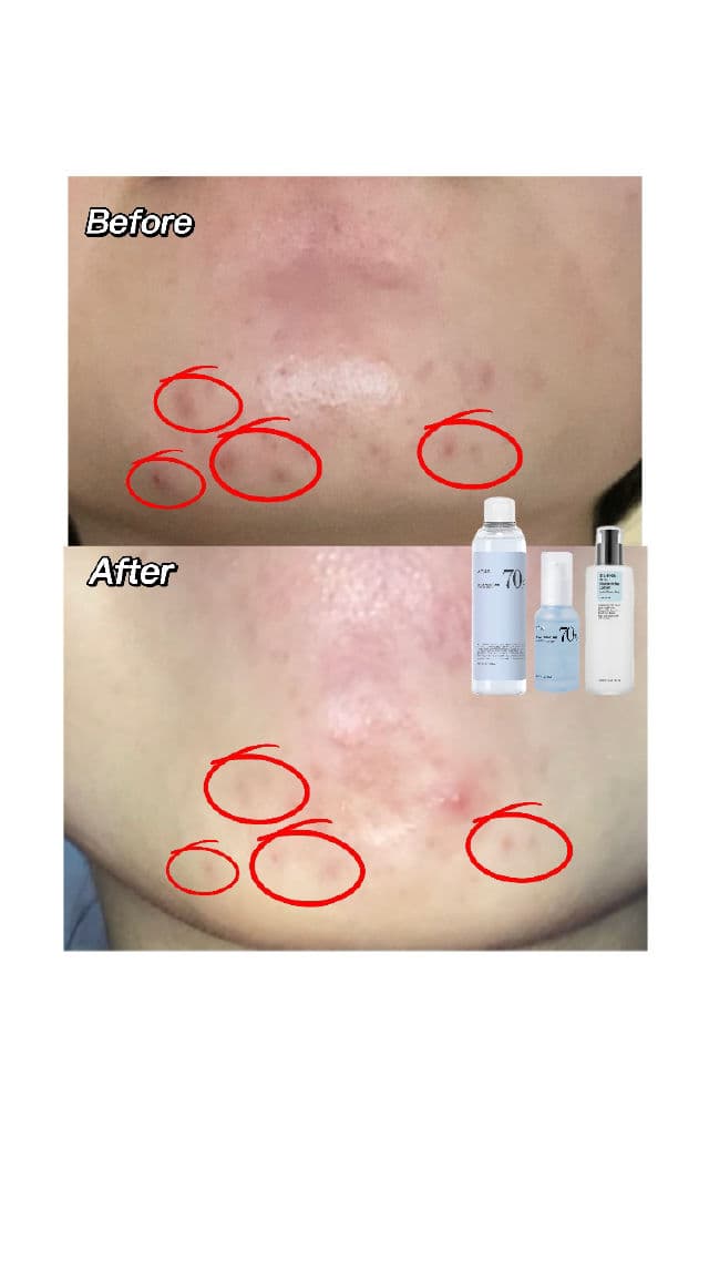 ANUA Birch Moisture Boosting Toner review photo by Leezy