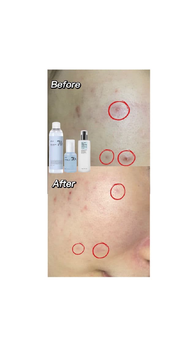 ANUA Birch Moisture Boosting Toner review photo by Leezy