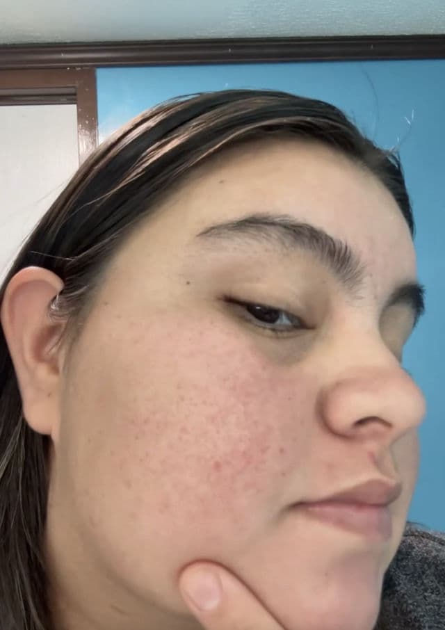 Dr.Pepti Centella Turnover Soft Peeling Gel review photo by Fernandareyes