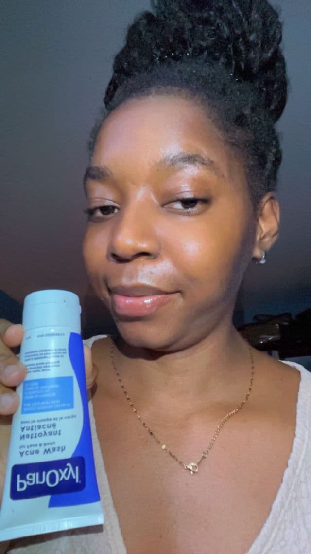 PanOxyl Acne Creamy Wash Benzoyl Peroxide 4% Daily Control review photo by myanca