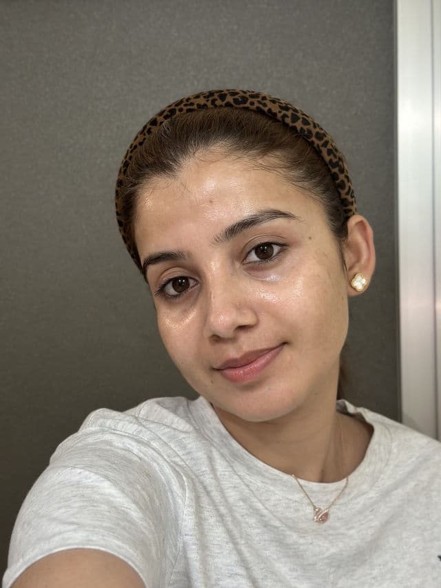 VT COSMETICS Pro Cica Reedle Shot 100 2-Step Hydrogel Mask review photo by Roshni4