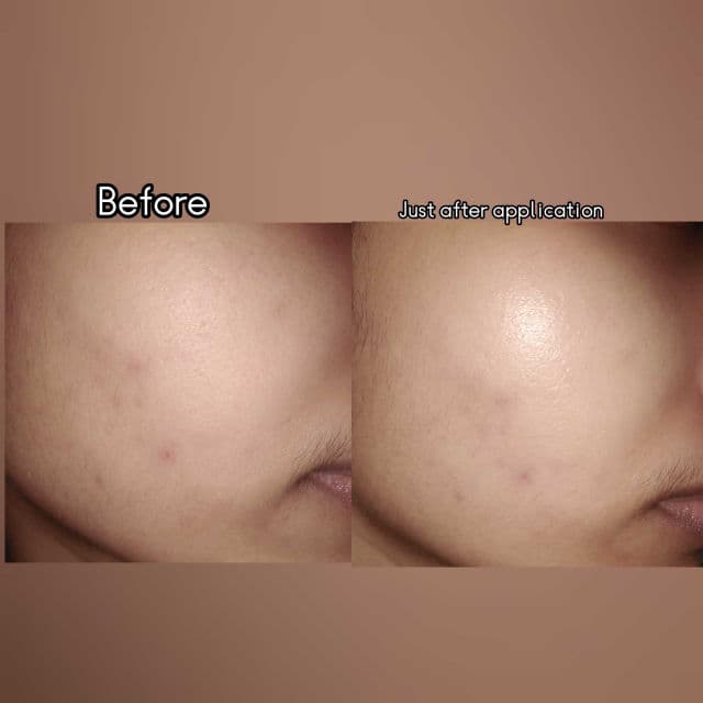 Coxir Black Snail Collagen Toner review photo by Nishat