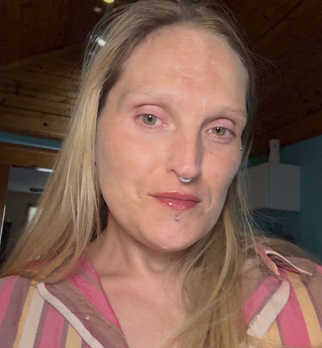 VT COSMETICS Reedle Shot Lip Plumper Beginner review photo by shalynamber