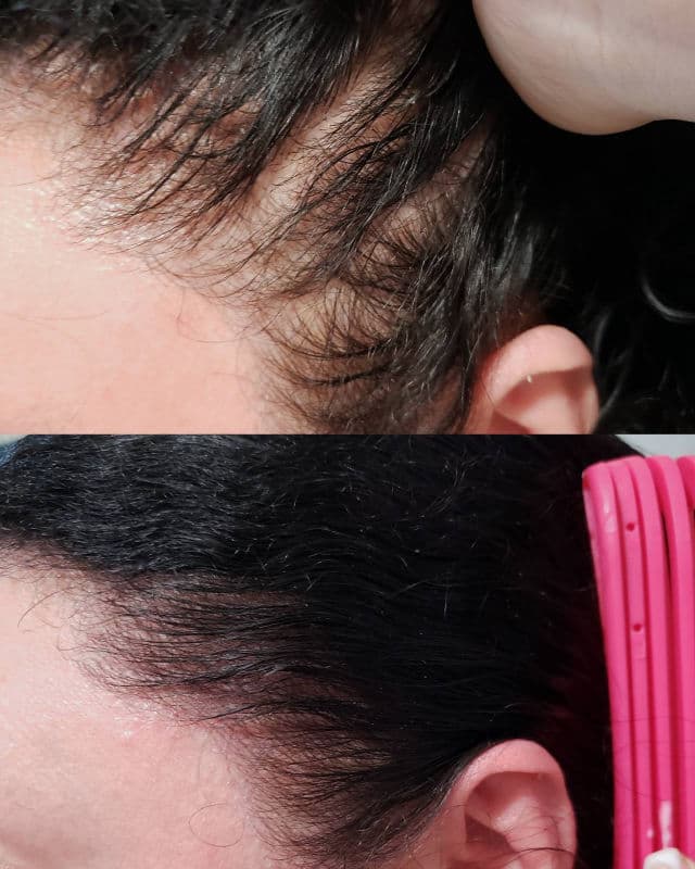 Dr.FORHAIR Folligen Original Shampoo review photo by AlottaxReviews