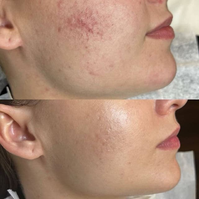 Dr.Pepti Centella Turnover Soft Peeling Gel review photo by Skinboo