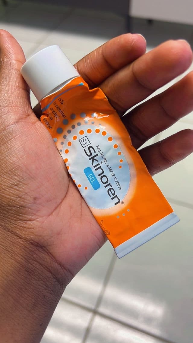 Bayer Skinoren (Azelaic Acid) 20% Cream review photo by StheN