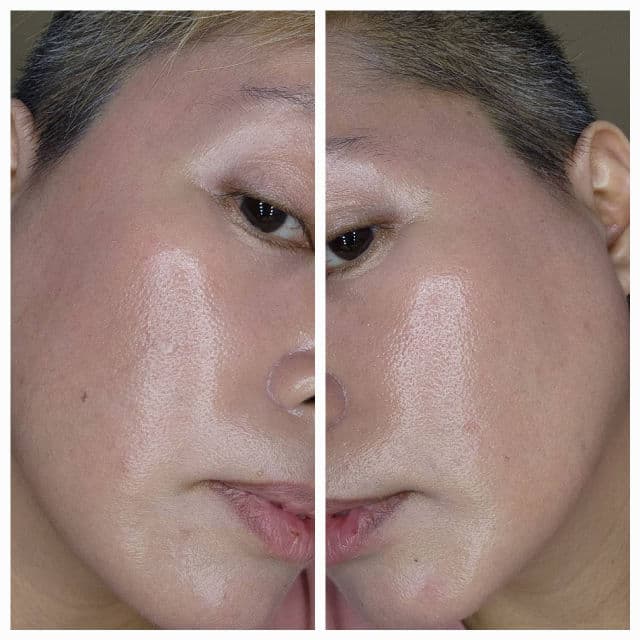 Frankly AHA 8.05 Clearing & Exfoliating Toner review photo by elaineganuelas