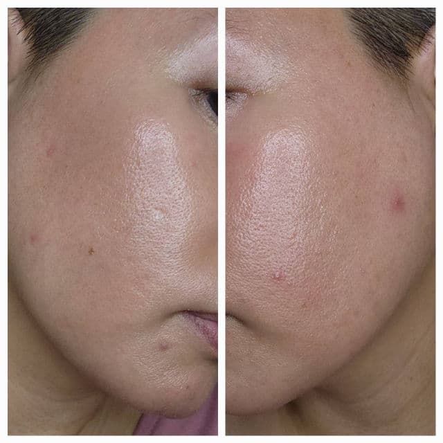 Frankly AHA 8.05 Clearing & Exfoliating Toner review photo by elaineganuelas