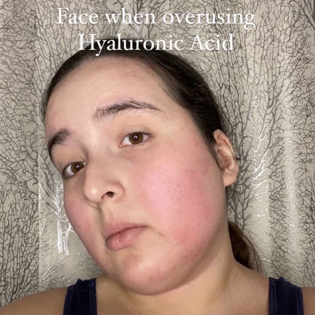 The Potions Hyaluronic Acid Ampoule review photo by chelsiapatel