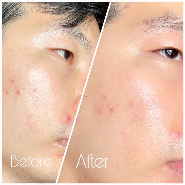deserve Everyday Hydrating Niacinamide Gel Cleanser review photo by weikian90