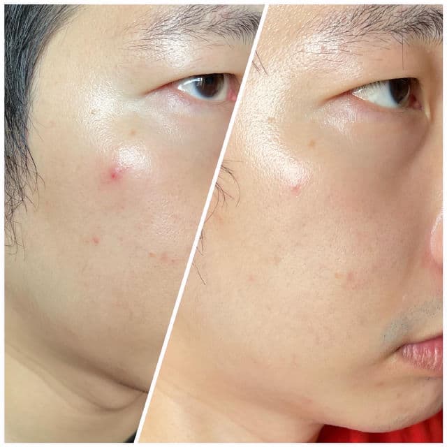 Ruruberry 18% Ethyl Ascorbic Acid Booster Drop review photo by weikian90