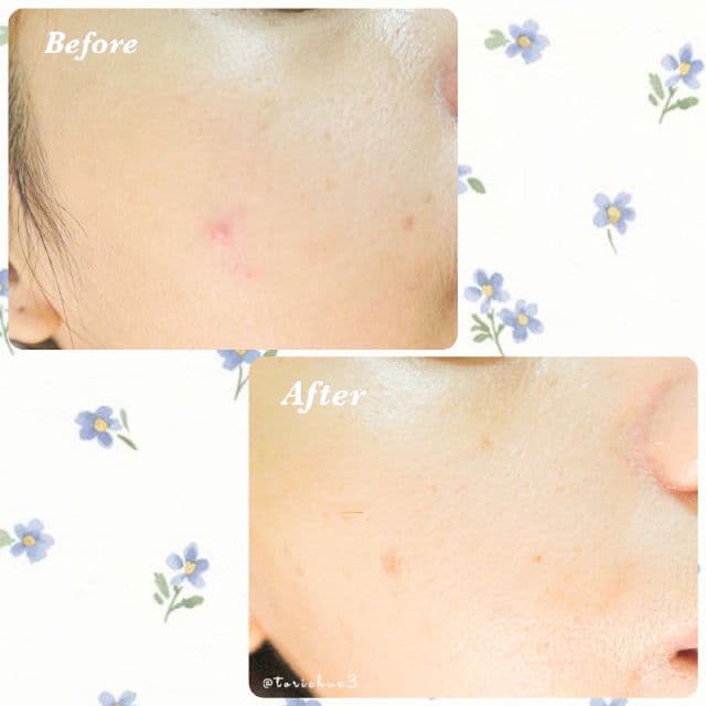 SKIN1004 Madagascar Centella Poremizing Fresh Ampoule review photo by torichu