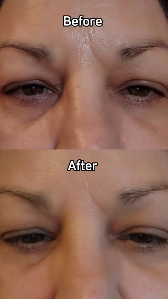 Dermelect Revitalite Eyelid and Dark Circle Corrector review photo by Lorelei