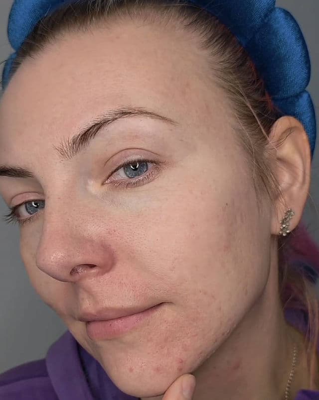 Centellian24 Madeca Matcha Pore Cleansing Oil review photo by sylababka89