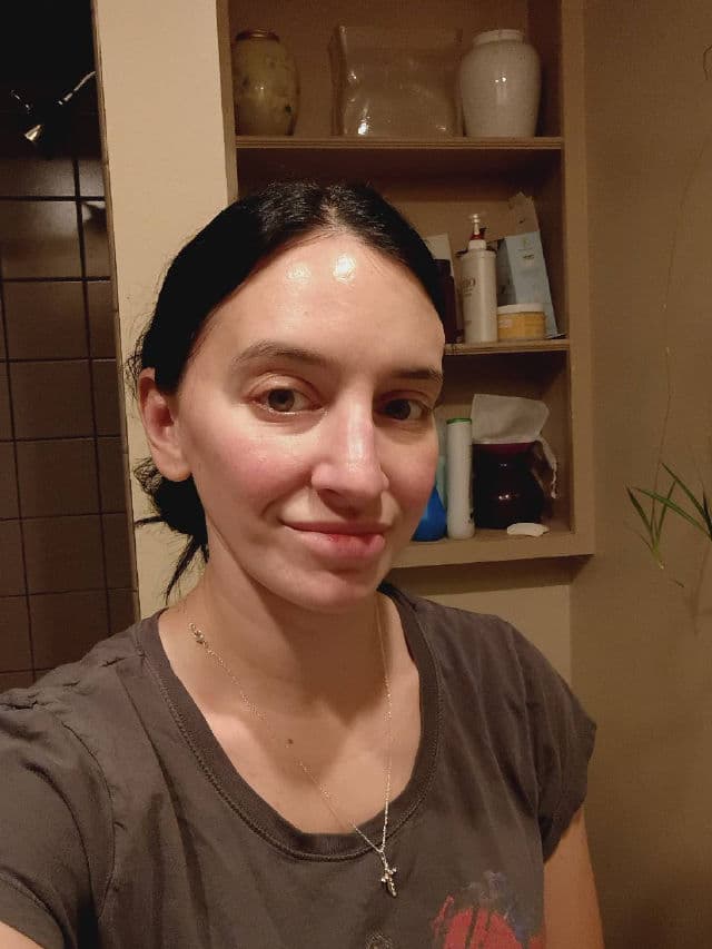 Lactic Acid 10% + HA product review