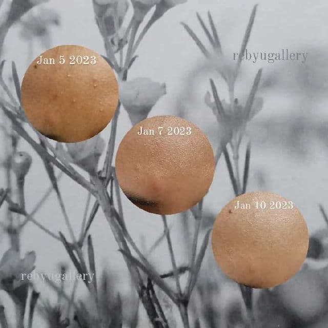 Nutrishe Acne & Blemish Advanced Serum  review photo by yunzie