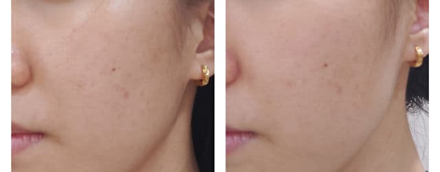 COMMONLABS Vitamin E Calming Ampoule review photo by cn24