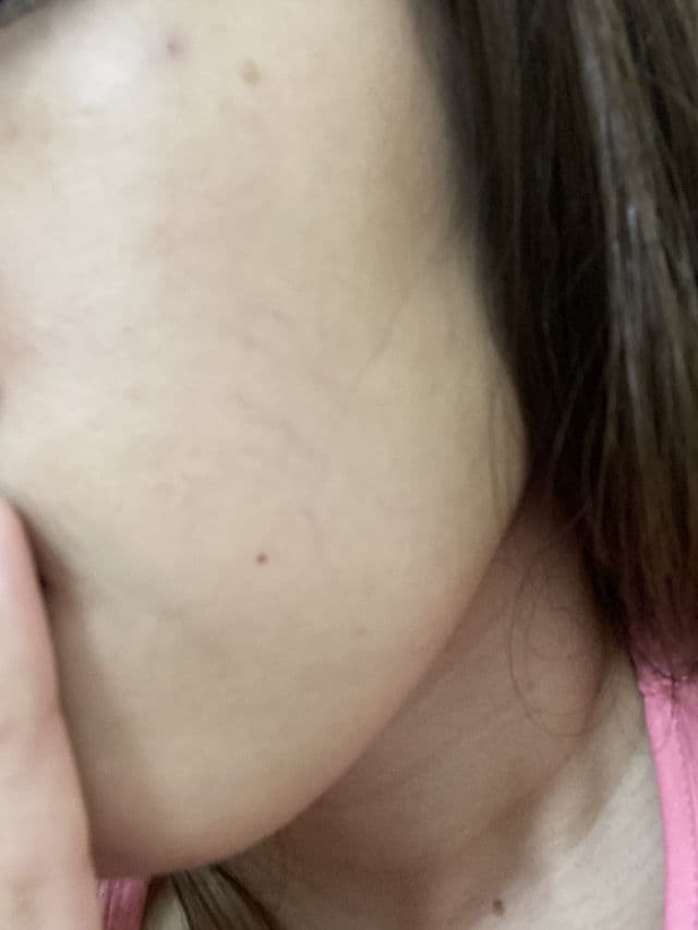 Pond's Healthy Hydration Watermelon Hydrating Jelly Moisturizer with Vitamin E review photo by Myka