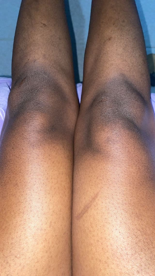 Jergens Hydrating Coconut Moisturizes & Softens Dry Skin Moisturizer review photo by Bestel