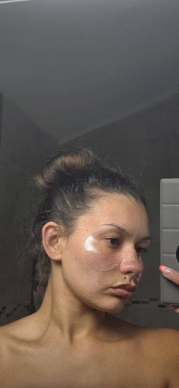 SNP Glutathione Dark Zero Toning Patch review photo by Chloo