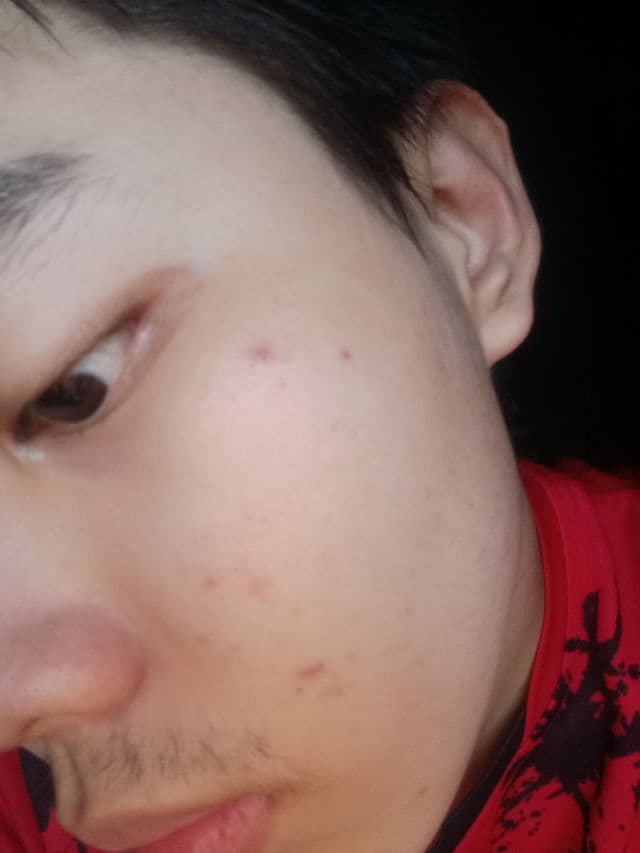 Scarlett Whitening Acne Night Cream review photo by ALPINOprananda