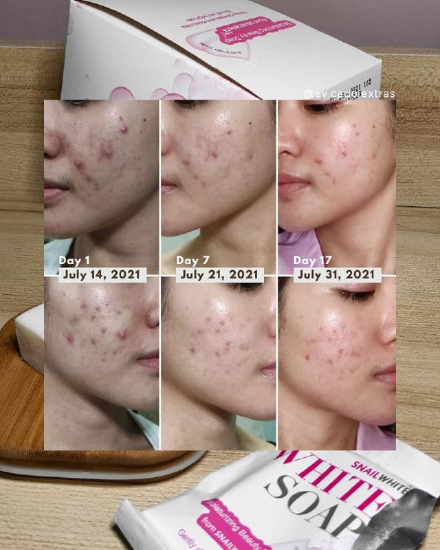 Snail White White Soap review photo by AVCado