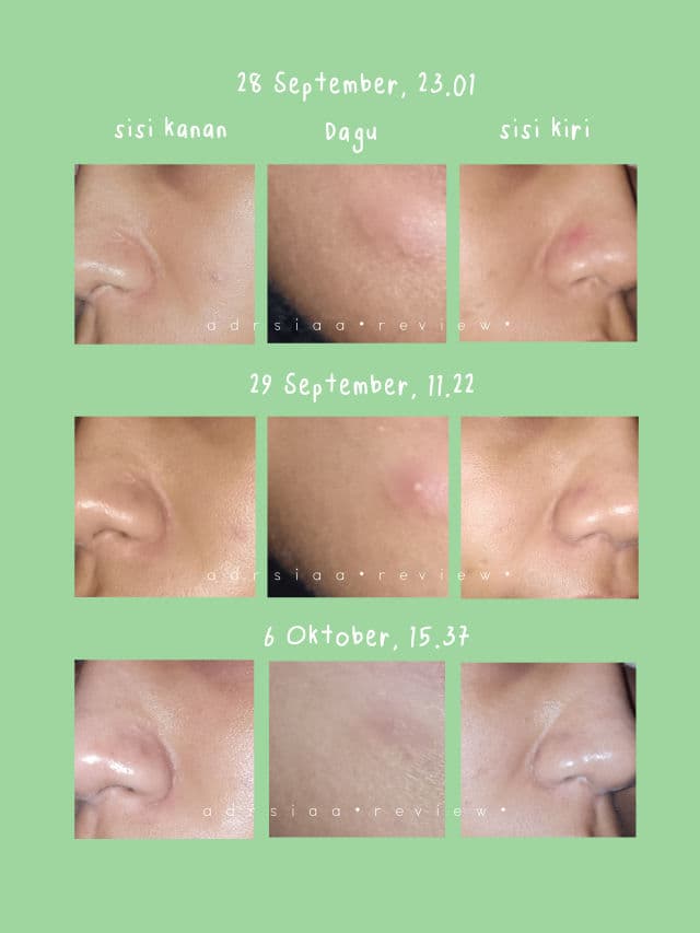 datglowskin Skinpair Serum review photo by Adrsiaa