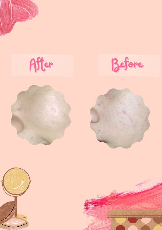 KLOIS Blemish Skin Serum review photo by Ailau