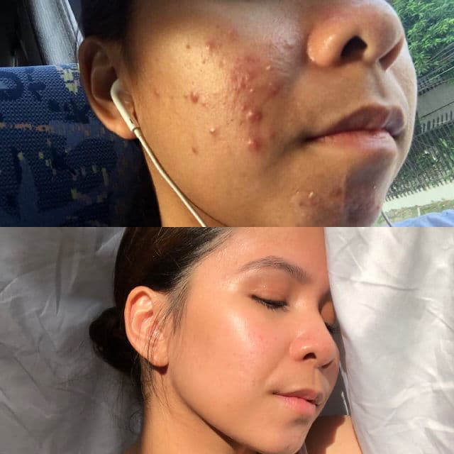 Wildleaf Vitamin C Serum review photo by Aixx