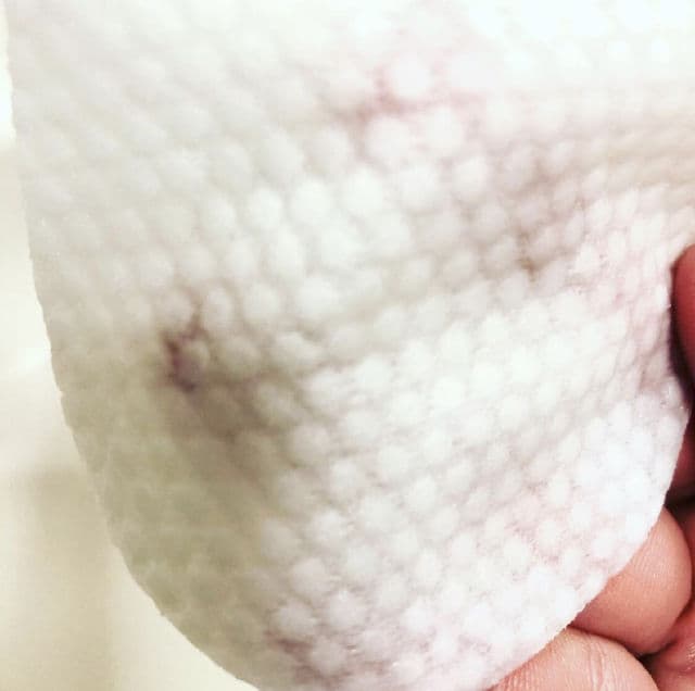 Huangjisoo Sakura Peeling Radiance Pads review photo by Ajsensitiveskincare