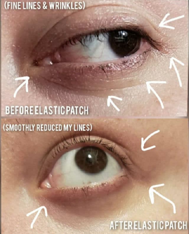 The Orchid Skin Elastic Under Youth Eye Patch review photo by AlottaReviews