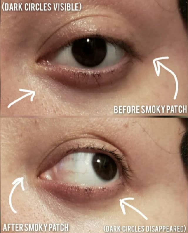 The Orchid Skin Smoky Under Clear Eye Patch review photo by AlottaReviews