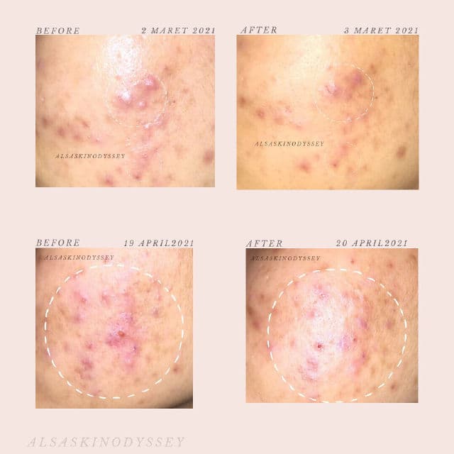 Bloomka Manuka + Magnolia Serum review photo by Alsaskinodyssey