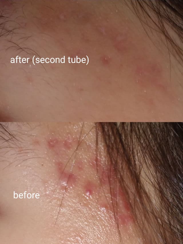 Cosmoderm Vitamin E Cream 1000 IU with Rosehip Oil review photo by AmIWhatIAm