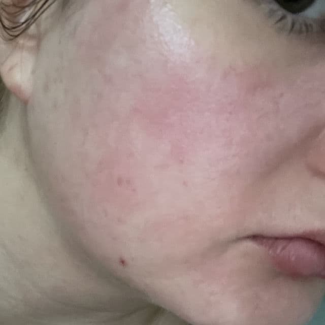 Burt's Bees Skin Nourishment Hydrating Gel Cream review photo by Anastasiya