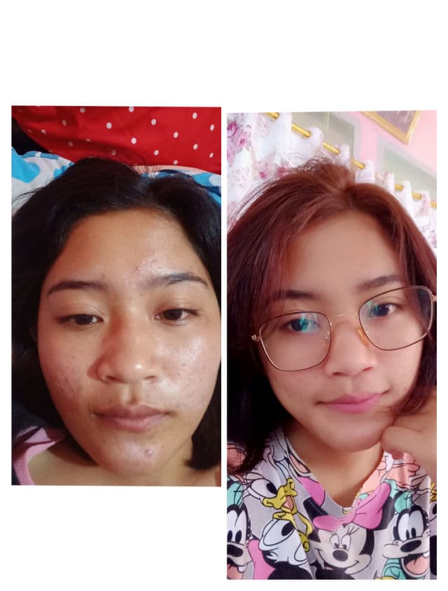 InstaNatural Niacinamide Serum review photo by Angel70