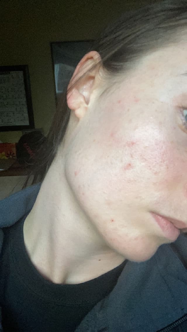 esmi Anti-Redness Minty Green Smoothie review photo by AnnieClement