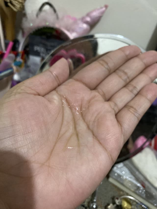 Apotheke Science Spot Treatment review photo by Arci2