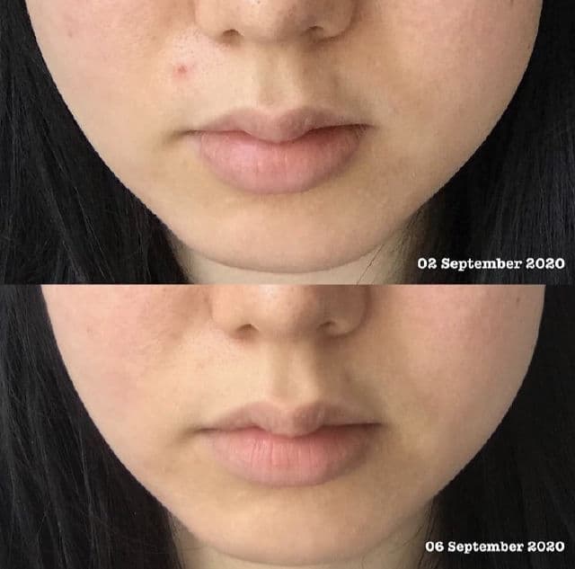 TOSOWOONG Tamanu 100% Botanic Oil review photo by Ariana