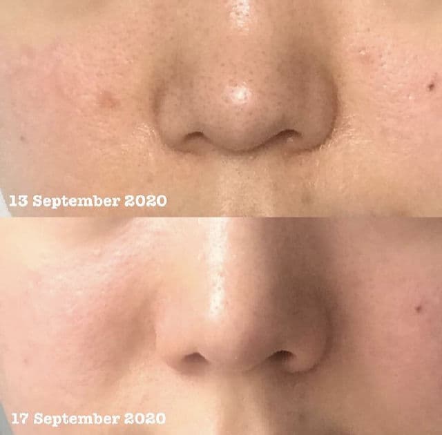 TOSOWOONG Tamanu 100% Botanic Oil review photo by Ariana