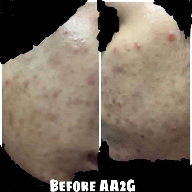 The Pastels Shop AA2G Hyperpigmentation Treatment Serum review photo by Arraaida