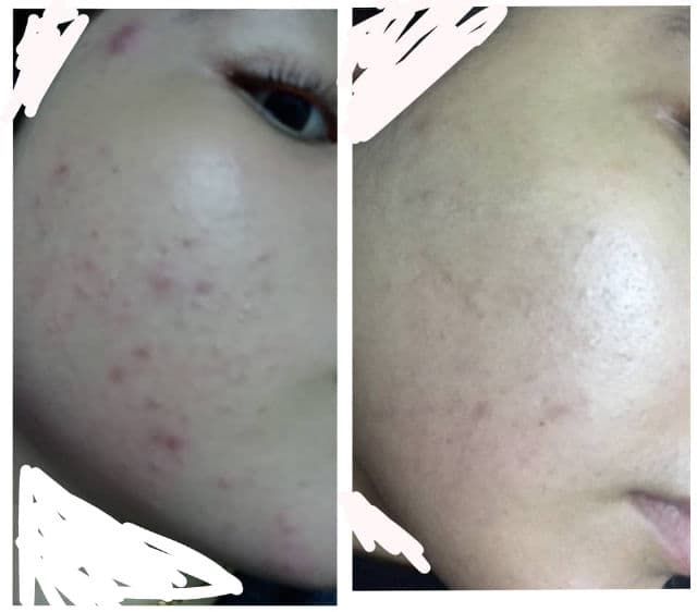 Hada Labo Super Hyaluronic Acid Hydrating Water Gel review photo by Axnx