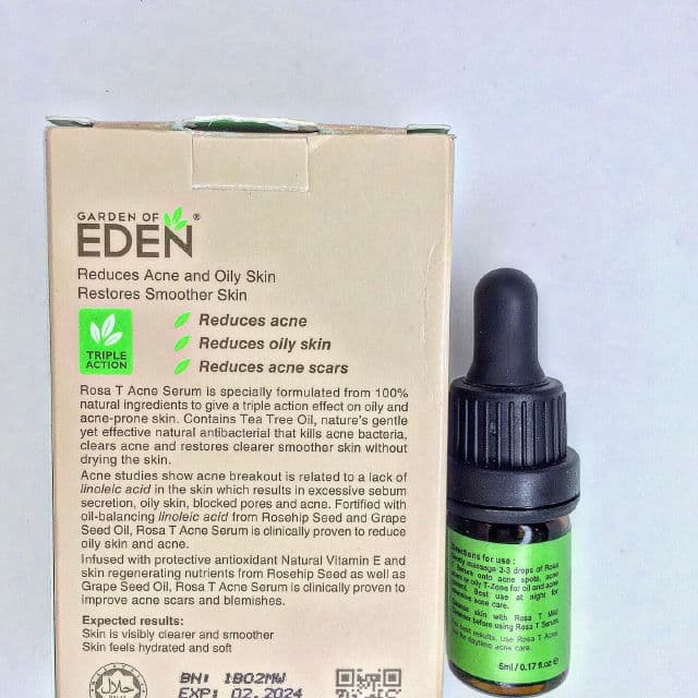 Garden of Eden Rosa T Triple Action Acne Serum review photo by AyzaRoslan