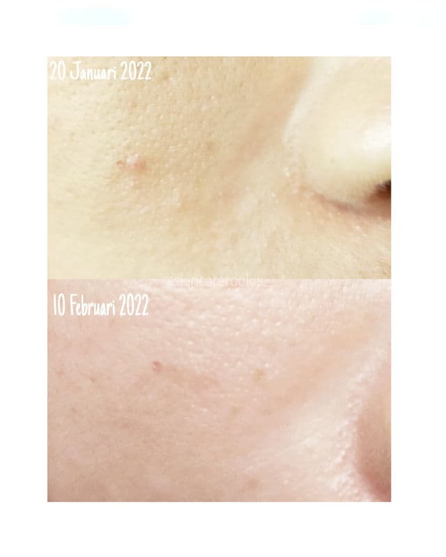 SKIN1004 Madagascar Centella Tone Brightening Capsule Ampoule review photo by Balgisps