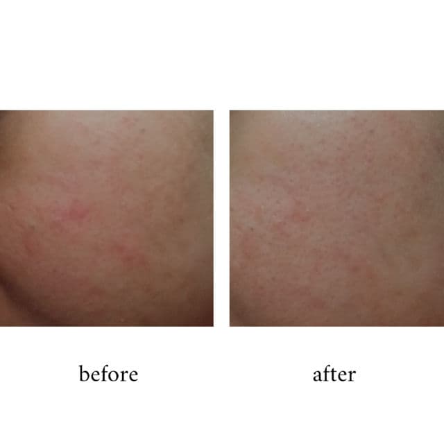 True to Skin Bakuchiol Skin Smoothing & Anti-Aging Serum review photo by BeautyDeiavy