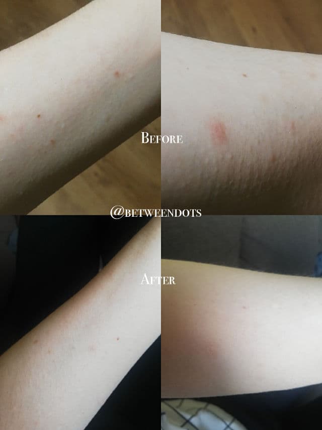 NEOGEN Dermalogy Real Vita C Powder Lemon review photo by Betweendots