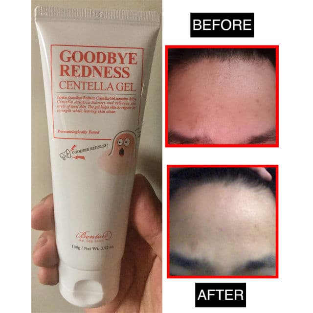 BENTON Goodbye Redness Centella Gel review photo by Brian15